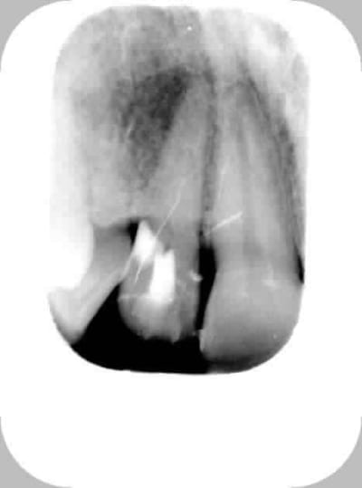 Patricia 20030205 2 yjimvn - Eugenol