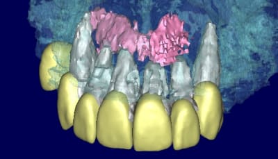 Patricia 3d2 qofhzt - Eugenol