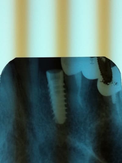 Pelicano tireae - Eugenol