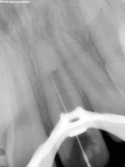 Per wk5mc9 - Eugenol