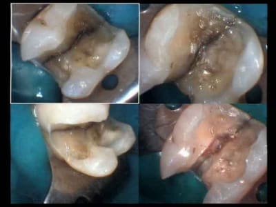 Perdue or not perdue ptcw8s - Eugenol
