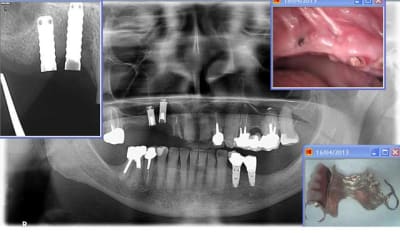 Pessoa2 pesghm - Eugenol
