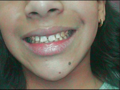 Petite3 r6bstq - Eugenol