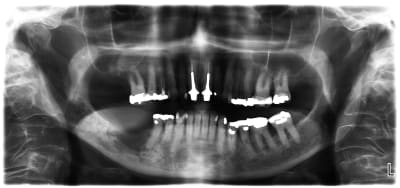 Pgqmdl1hdyjinmjiqxbt - Eugenol