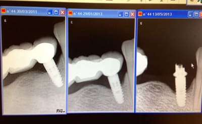 Photo 1 oksu0t - Eugenol