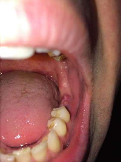 Photo 1 - Eugenol