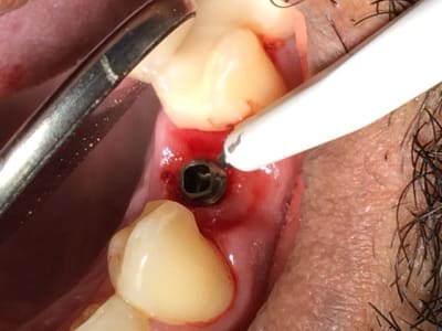 Photo 4 h2isvi - Eugenol