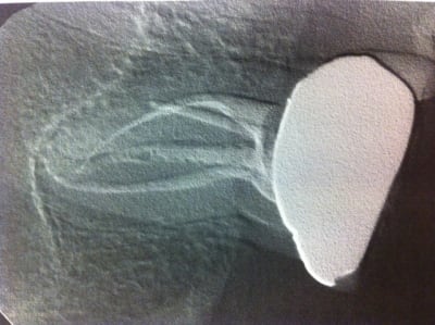 Photo  3  wlnoeh - Eugenol