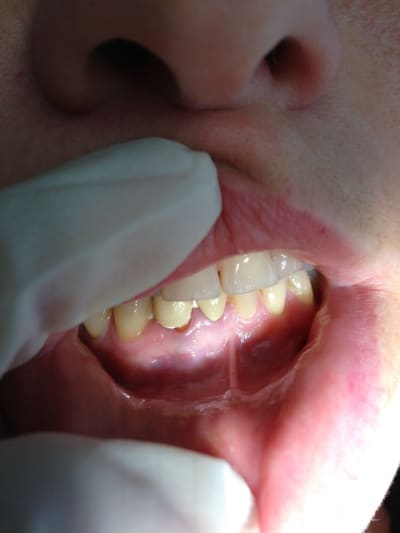 Photo kjmrhv - Eugenol