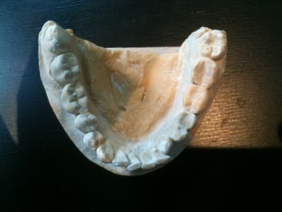 Photo mandibule q54iue - Eugenol