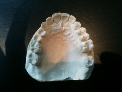 Photo maxillaire j8gmpn - Eugenol