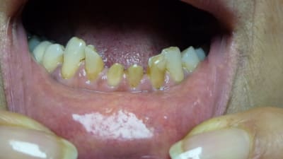 Photo ubwe5a - Eugenol