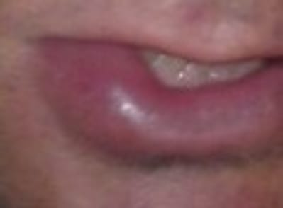 Photo ym4ivu - Eugenol