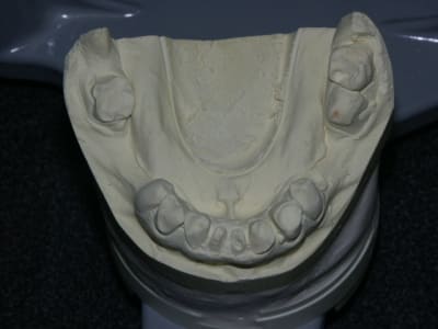 Pict0258 nw5fy9 - Eugenol