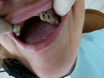 Piece numero  hdjug0 - Eugenol