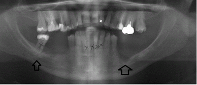Pla tj59a5 - Eugenol