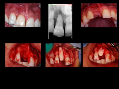 Planche1 king6b - Eugenol