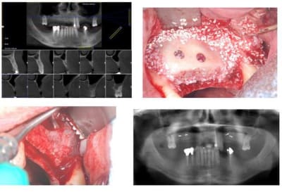 Planche 1 fx9sim - Eugenol