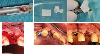 Planche 2 b6s05y - Eugenol