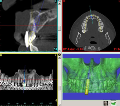Planif eampkx - Eugenol