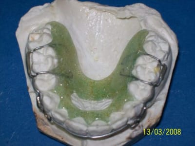 Plaque de contention jltvru - Eugenol
