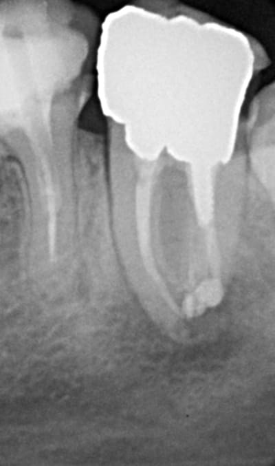 Post qlw87x - Eugenol