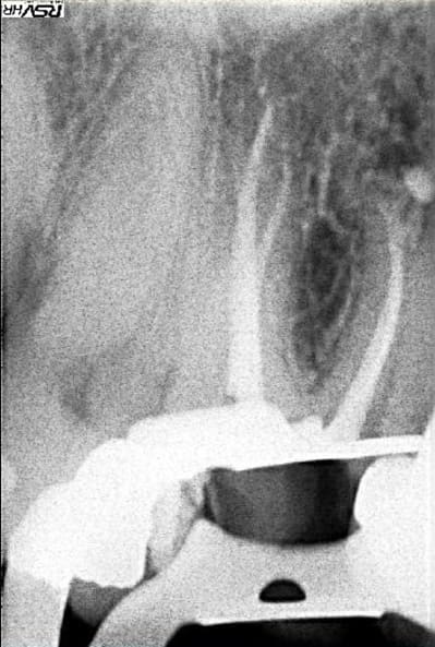Postop16 oetolv - Eugenol