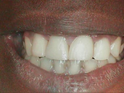 Pour ses copains iv7aac - Eugenol