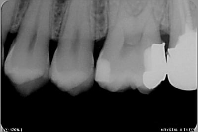 Pr  op 1 copy i9xxjl - Eugenol