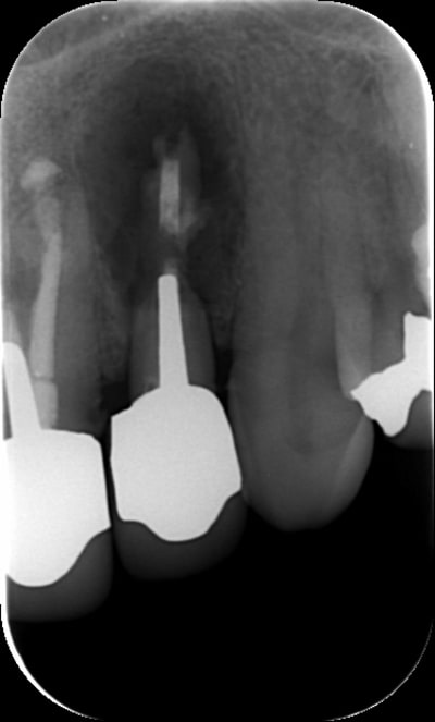 Pre c wfmpz3 - Eugenol
