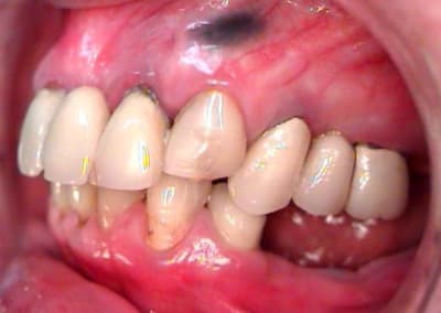 Prf3 ghkzmt - Eugenol