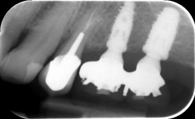 Q753h2limbcpmq4d78wu - Eugenol