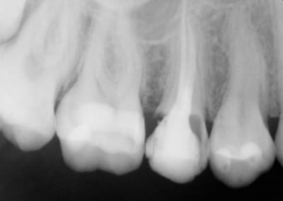 Qg5svu4fnsvjubquojt9 - Eugenol