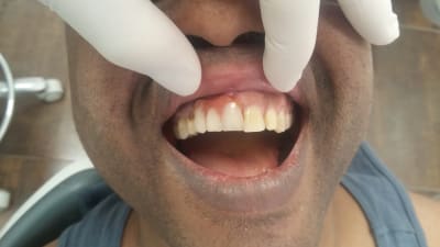 Qpoysa6doagwnzgu2xek - Eugenol