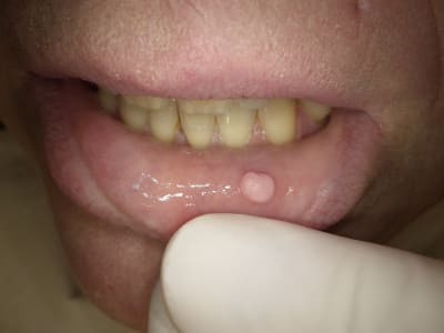 Qtuykqxsh6ap7hmc27d2bljg5jiu - Eugenol