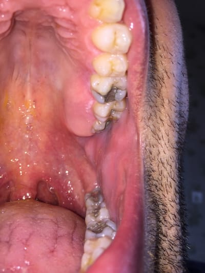 Qwqramv6utnoqjqbfxbr - Eugenol