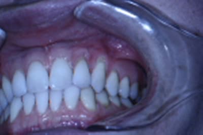 Récessions1 xjjigz - Eugenol