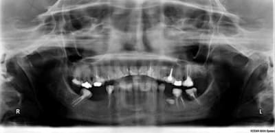 Radio2 inxh0l - Eugenol