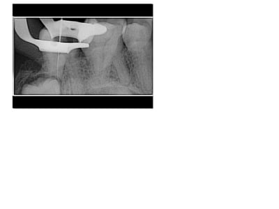 Radio 2 wfvcad - Eugenol