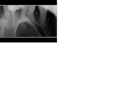 Radio 5 ycjkcc - Eugenol