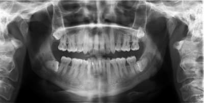 Radio 6 fpyw0m - Eugenol