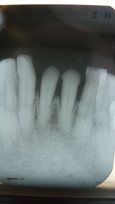 Radio dbfsmv - Eugenol