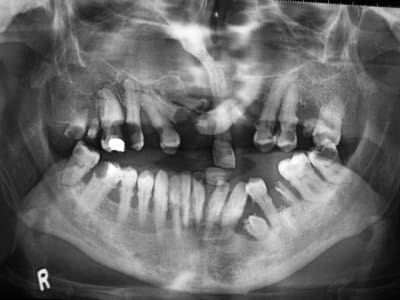 Radio fwwmcq - Eugenol