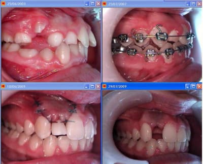 Ratage1 z7hwmm - Eugenol