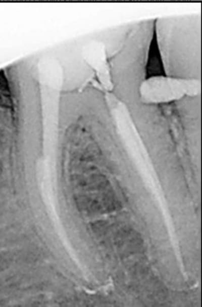 Recadrage pvujom - Eugenol