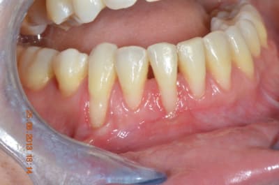 Recesssions 002 cm1a1j - Eugenol