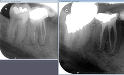 Reprise q1xgmd - Eugenol