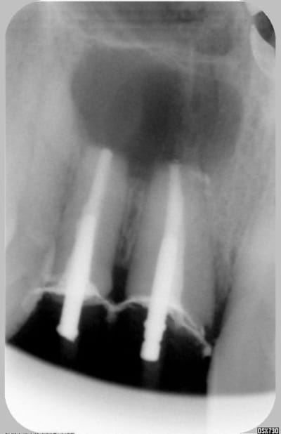 Resec gtdmaw - Eugenol