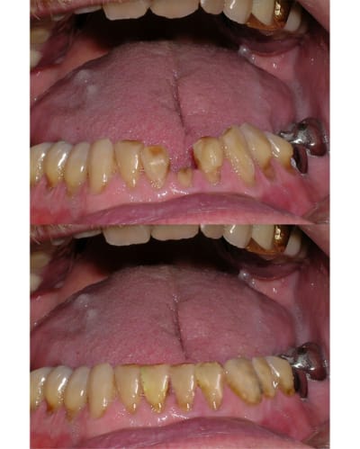 Retouche photo1 z5fzv6 - Eugenol