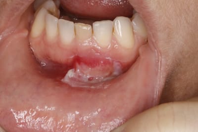 Rfogiafrqncptljophau - Eugenol